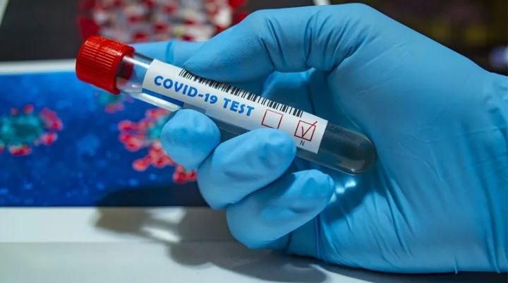 Chile ya hizo más de 1.600.000 tests de coronavirus