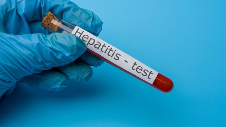 Cómo se trató en Gran Bretaña a los casos de hepatitis aguda de causa desconocida