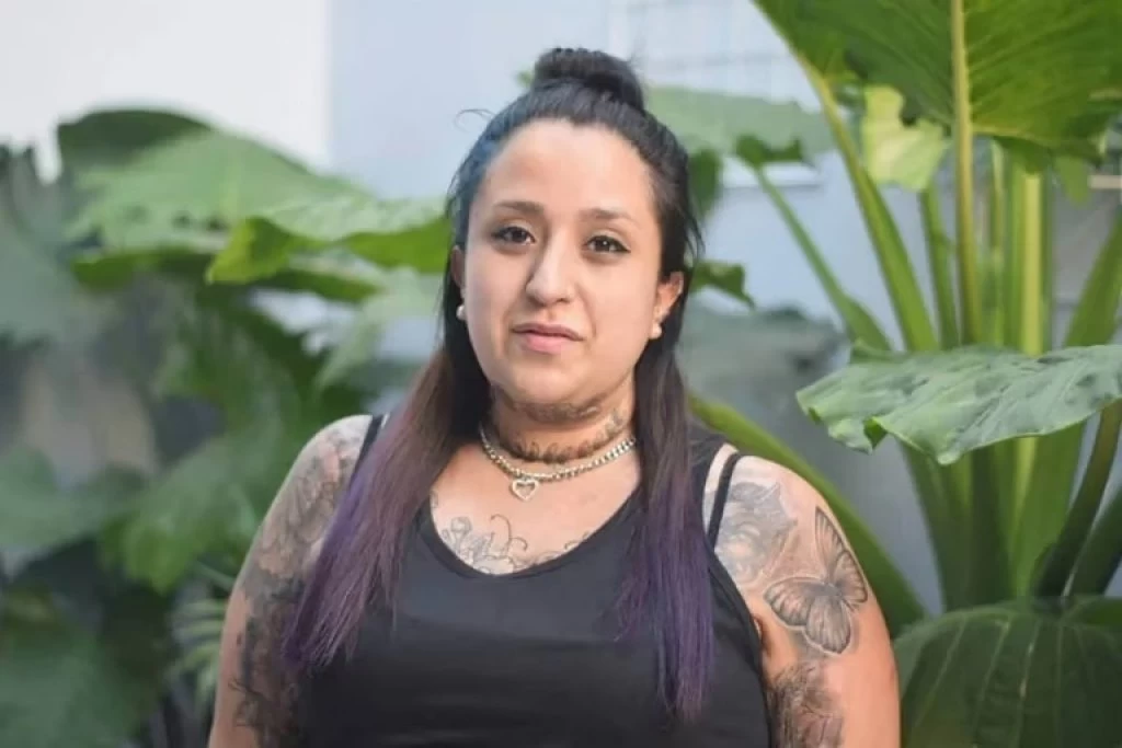 Érika Altamiranda, se quemó el 40% del cuerpo en un accidente doméstico: "Sufría una depresión muy grande y lo que me pasó me ayudó a salir"
