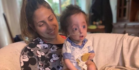 La inspiradora historia de Vito, el niño que nació con el 'síndrome de Benjamin Button'