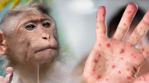 Eduardo López: "Tenemos viruela del mono y el norovirus"