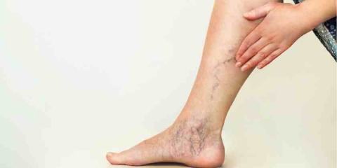 ¿La vacuna contra el Covid-19 produce trombosis?
