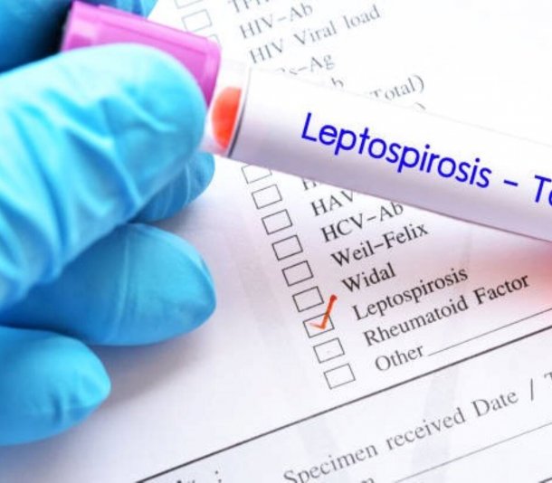 Leptospirosis; No Demonicemos a las Achuras