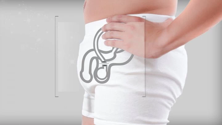 Vasectomía: mitos y verdades sobre esta práctica anticonceptiva
