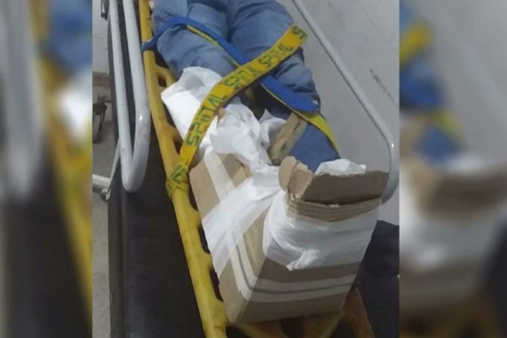 Chaco: sufrió una fractura expuesta y lo entablillaron con pedazos de cartón