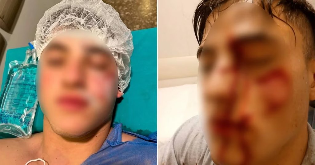 La madre de Nicolás García, atacado con un vaso en un boliche: “Mi hijo recibió 400 puntos en la cara y no sabemos si va a perder el ojo”